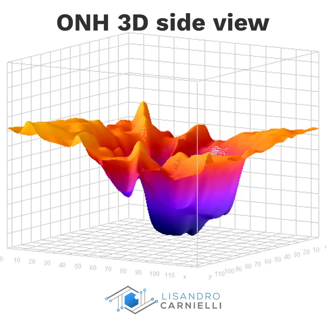 ONH 3D, side view